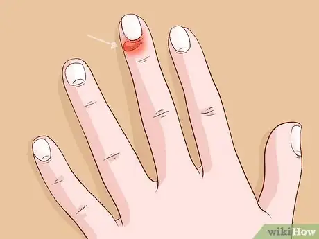 Imagen titulada Care for Your Nails Step 10