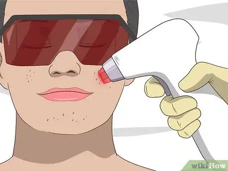Imagen titulada Get Rid of Acne Cysts Fast Step 22