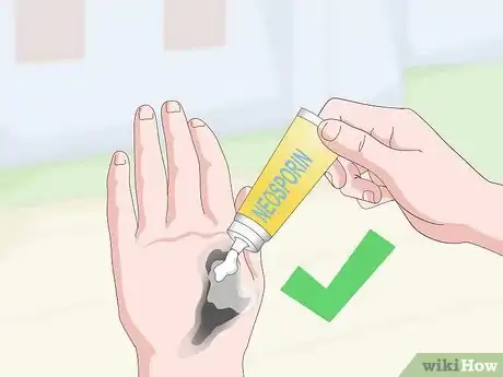 Imagen titulada Remove Tar From Skin Step 8