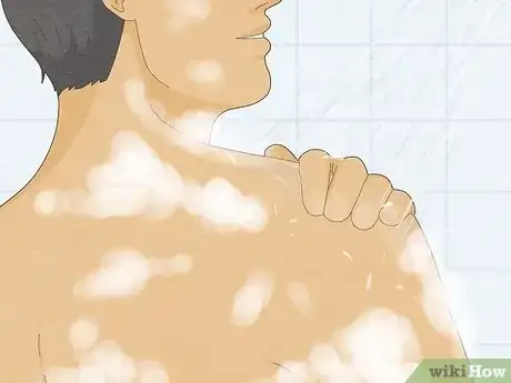 Imagen titulada Get Healthy Skin Step 1