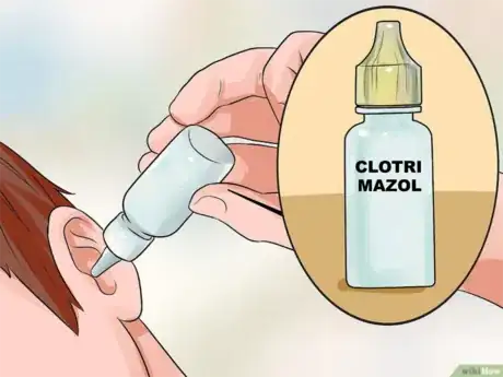 Imagen titulada Treat_a_Fungal_Ear_Infection_Step_6