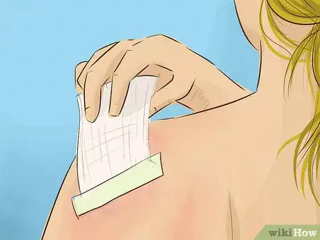 Imagen titulada Treat a Sunburn Step 17
