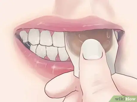 Imagen titulada Treat Gum Disease With Home Made Remedies Step 3