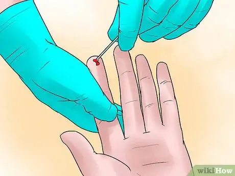 Imagen titulada Live With HIV/AIDS Step 10