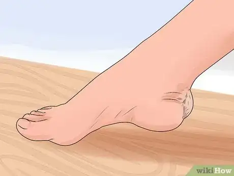 Imagen titulada Care for a Burst Blister Step 3