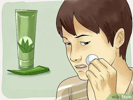 Imagen titulada Get Rid of a Cold Sore with Home Remedies Step 10