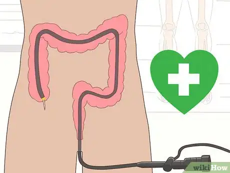 Imagen titulada Detect Rectal Cancer Step 8