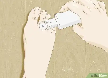 Imagen titulada Make a Natural Foot Odor Remedy Step 4