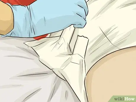 Imagen titulada Change Teen Diapers Step 13
