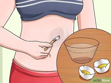 Imagen titulada Get Rid of Stretch Marks Fast Step 3