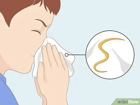Imagen titulada Know If You Have Worms Step 27