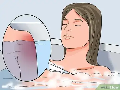 Imagen titulada Take a Sitz Bath Step 5