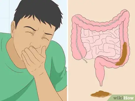 Imagen titulada Know If You Have Worms Step 18