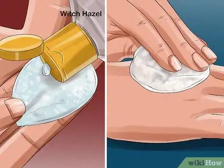 Imagen titulada Apply Witch Hazel to Your Face Step 11