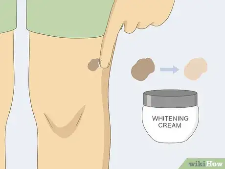 Imagen titulada Remove Moles Quickly Step 18