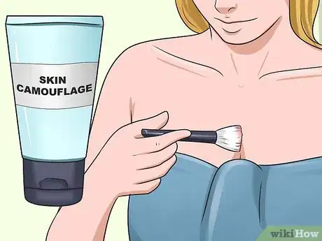 Imagen titulada Get Rid of Stretch Marks Fast Step 9