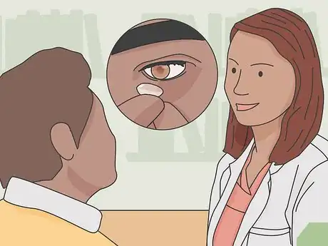 Imagen titulada Deal With Uncomfortable Contact Lenses Step 15