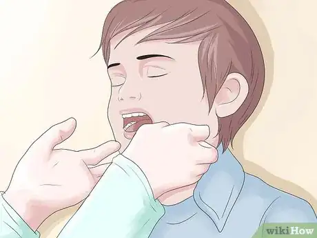 Imagen titulada Know if Your Child Has Scarlet Fever Step 1