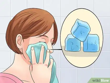Imagen titulada Decrease the Size of a Pimple Overnight Step 5