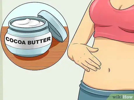 Imagen titulada Get Rid of Stretch Marks Fast Step 8