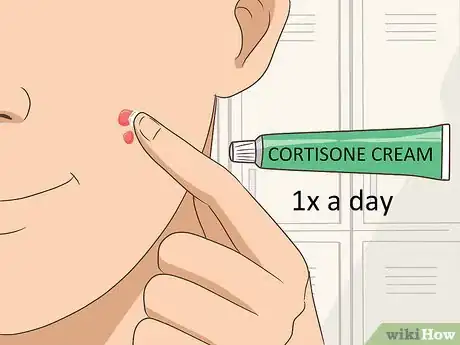 Imagen titulada Get Rid of Acne Cysts Fast Step 18