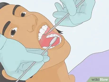 Imagen titulada Make a Fake Retainer Out of Wax Step 4