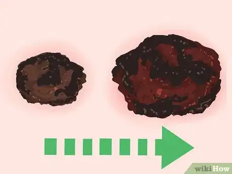 Imagen titulada Recognize Melanoma Step 5