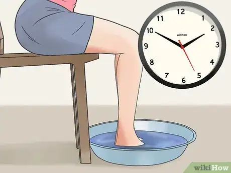 Imagen titulada Prevent Frostbite Step 27