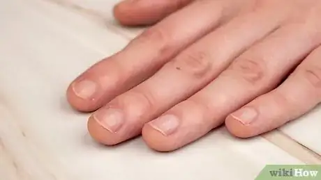 Imagen titulada Keep Your Nails Healthy Step 18