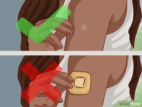 Imagen titulada Read a Tuberculosis Skin Test Step 2