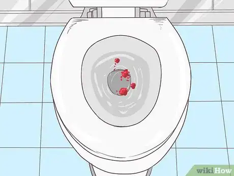 Imagen titulada Stop Rectal Bleeding Step 2