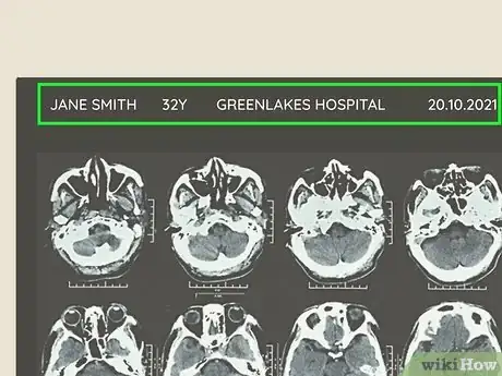 Imagen titulada Read a CT Scan Step 1