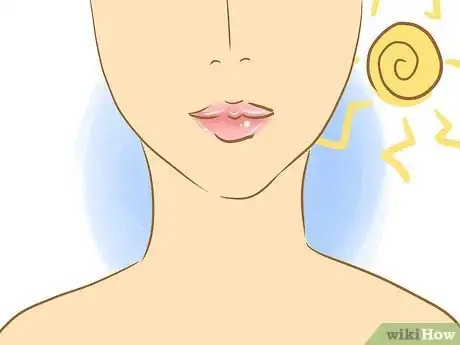 Imagen titulada Stop Picking Your Lips Step 13