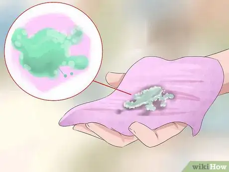 Imagen titulada Diagnose Vaginal Discharge Step 5