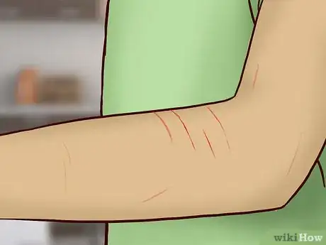 Imagen titulada Deal With a Cat Scratch Step 9