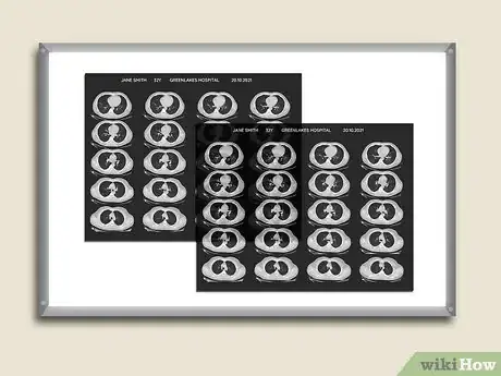 Imagen titulada Read a CT Scan Step 7