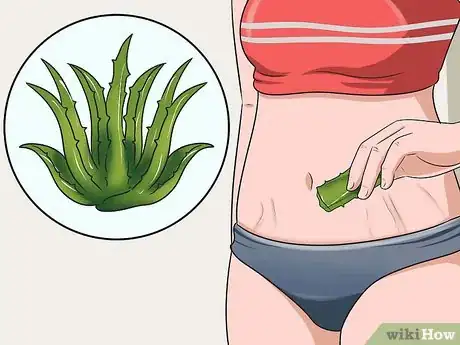 Imagen titulada Get Rid of Stretch Marks Fast Step 2