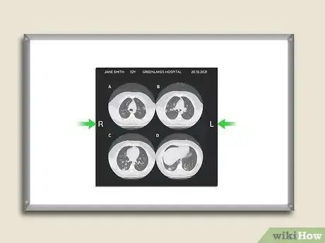 Imagen titulada Read a CT Scan Step 4