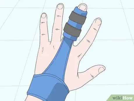 Imagen titulada Cure an Infected Finger Step 4