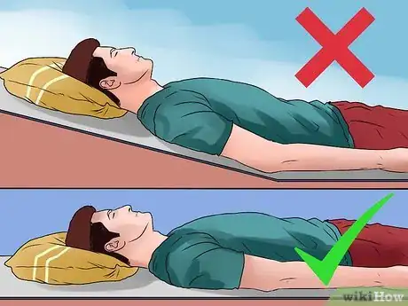 Imagen titulada Treat Costochondritis Step 10