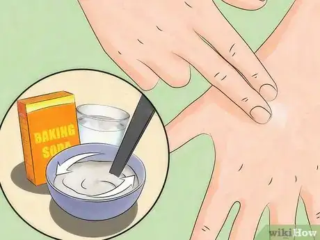 Imagen titulada Deal With a Mosquito Bite Step 1