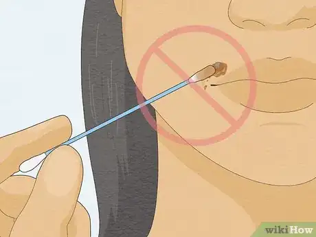 Imagen titulada Remove a Mole with Iodine Step 14