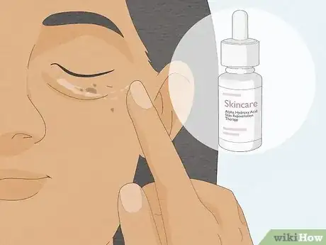 Imagen titulada Get Healthy Skin Step 24