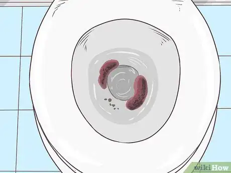 Imagen titulada Stop Rectal Bleeding Step 3