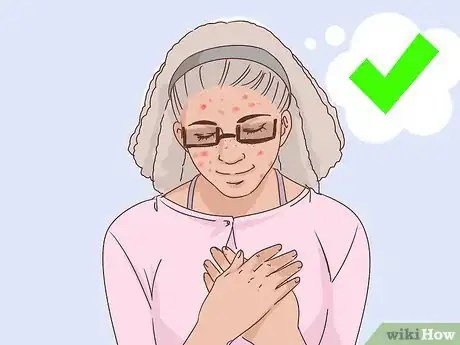 Imagen titulada Deal with the Effect of Acne on Self Esteem Step 2