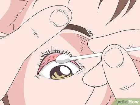 Imagen titulada Get Stuff out of Your Eye Step 3
