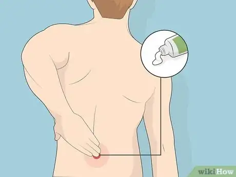 Imagen titulada Untrap a Nerve in Your Lower Back Step 15