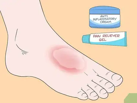 Imagen titulada Treat Extensor Tendonitis Step 9