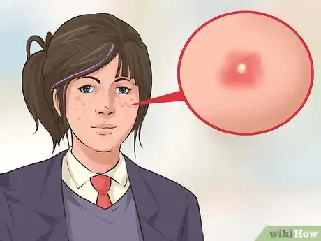 Imagen titulada Fake Your Period Step 12