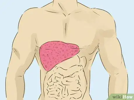 Imagen titulada Stop Alcohol Withdrawal Shakes Step 15